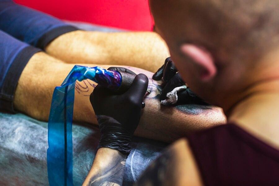 tattoo removal